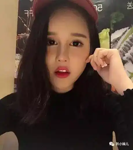 赵本山老婆承认女儿整容,病态迷恋打针花30万做鼻子如今球球自曝欲结婚嫁豪门