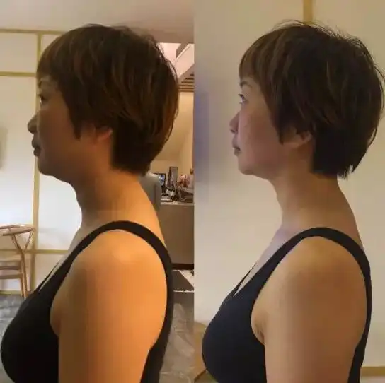 郎朗老婆旧照曝光,人间芭比骗了所有人,网友美女根本不是天生的