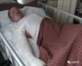 暖心古镇爱心人士为烧伤一家三口,送去9万元救命款