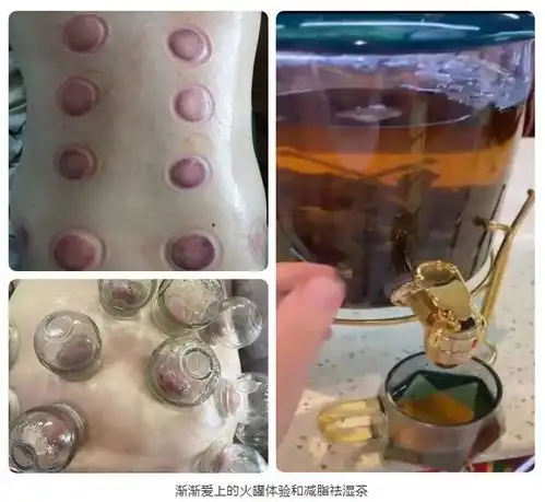 杭州一男子胖到快230斤,被劝切胃减肥,但这种温吞的方式却让他持续掉秤