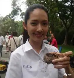 偶遇郭碧婷素颜逛街,额头上贴着胶布,遭质疑微整形,可是她的发际线...