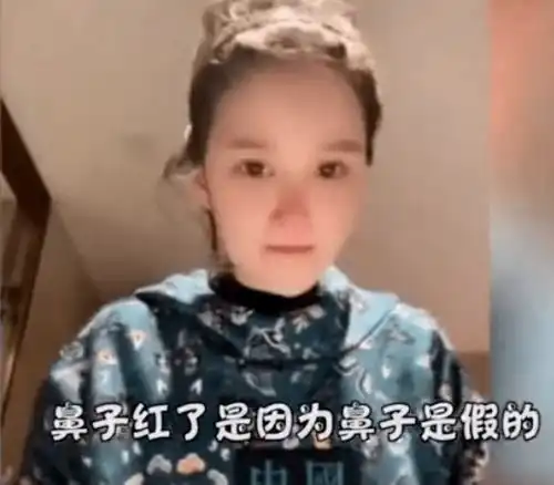 赵本山老婆反对女儿整容,曝其病态迷恋打针,后者曾花30万做鼻子