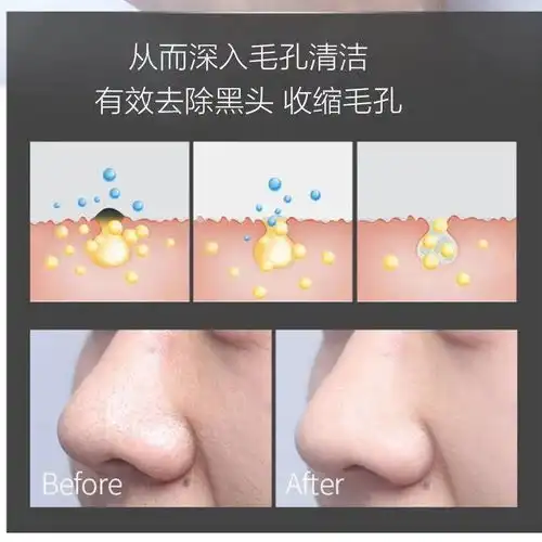 抢抢抢男士洗面奶洁面乳清爽保湿清洁毛孔控油祛痘去黑头除螨虫深层清洁