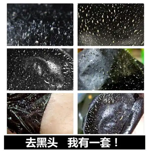 竹炭去黑头收缩毛孔套装男女吸祛粉刺导出液撕拉式面膜鼻头贴神器mz福卡商城