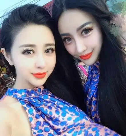 29岁女子整容上瘾,花费70多万元整容20次,整容后变蛇精