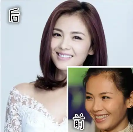 36岁高圆圆用经验告诉你,国民女神的一口白牙是怎样炼成的