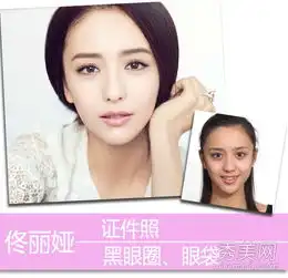残忍亮出证件照女星素颜暴露肌肤问题