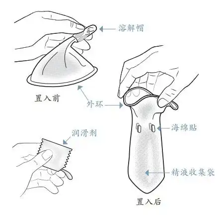 真人演示女用避孕套使用方法