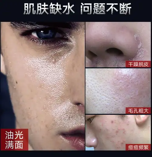 麦芙迪洗面奶男士护肤品套装去黑头撕拉面膜美白祛痘控油爽肤水