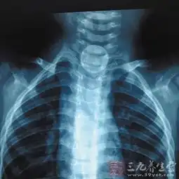 合肥3岁女童误吞枣核肠穿孔致小肠切除