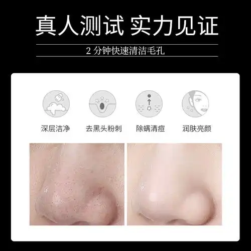 男士除螨皂洗脸香皂祛痘除螨虫手工肥皂竹炭去黑头清洁洗澡硫磺皂
