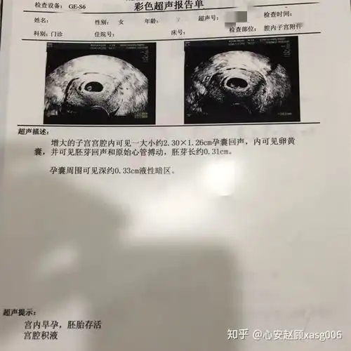 高龄加上卵泡少,我还能通过试管成功怀孕吗