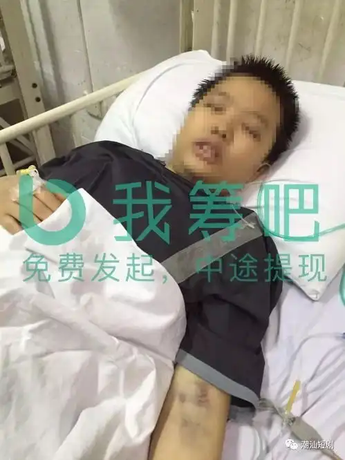 求助坝头百二两11岁少年得白血病,其目前残疾,家庭贫困