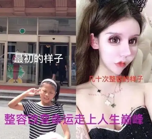 16岁开始整容,花400多万整了200多次的红粉宝宝,现状如何