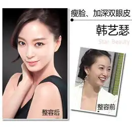 韩国女星整容位置大揭秘李多海韩彩英整容上位