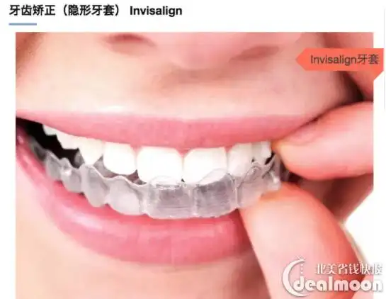 美人在骨不在皮,变美的第一步其实是整牙