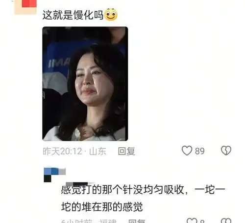 太吓人了佟大为老婆关悦的脸肿成白面馒头,和董璇形成鲜明对比