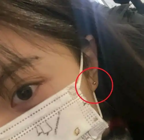 赵今麦读大学后换新发型,口罩也遮不住美貌,但耳朵位置更惹眼