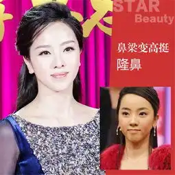 女主播整容上位柳岩沈梦辰杨乐乐谁变化大