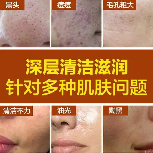 撕拉面膜美白补水学生女祛斑去黑头粉刺鼻贴去角质去死皮祛痘神器