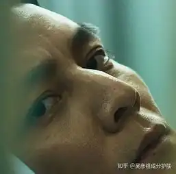 男士如何去黑头无推广只干货