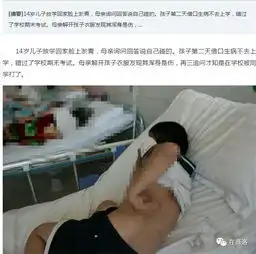 因琐事发生矛盾,镇安县两校学生手持刀具钢管街头打架,致3人受伤,其中1人惨遭破相同学