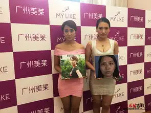 广东鼻整形救助与修复基地成立鼻整形失败可申请基金