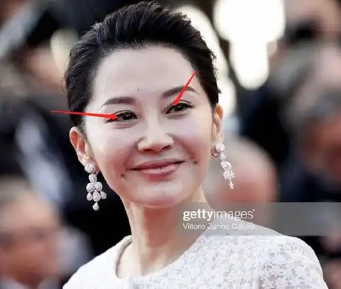 医学