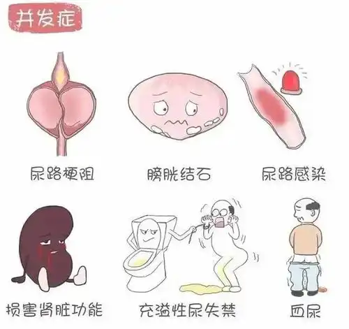 成都瑞梦热蒸汽治疗尿频尿急排尿困难小心前列腺增生