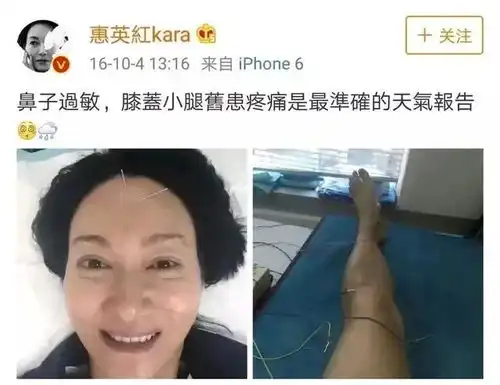 东山再起的传奇女星惠英红打星出身,自杀未遂,曾为成名走弯路