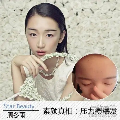 90后女演员长得又丑又丑,以至于郑爽和周东宇脸上都长满了粉刺