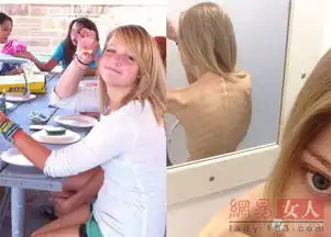 少女用亲身经历告诉所有女生不要过度节食