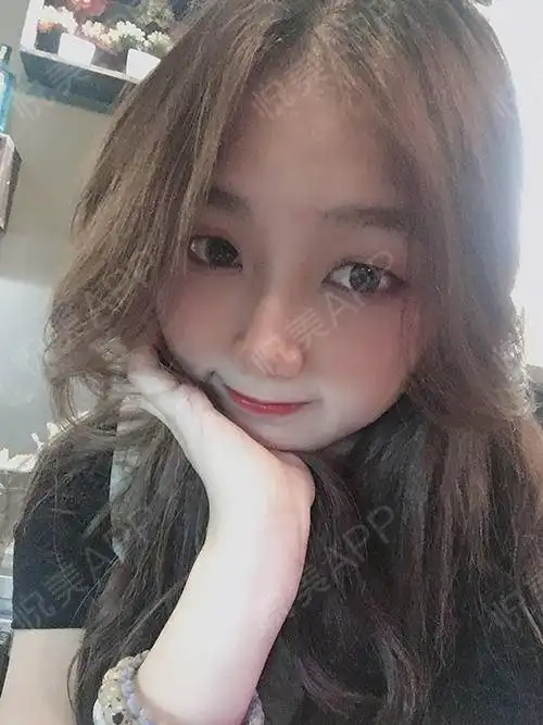 嗨喽嗨喽小美女们来更新啦,迫不及待来反馈热玛吉的皮...紧致提升悦美整形