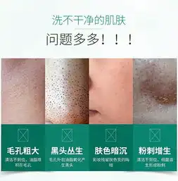 泉兮墨藻净肤泡泡洁面乳男女士泡沫洗面奶控油深层清洁去黑头补水保湿青少年学生祛痘除螨洁面乳10