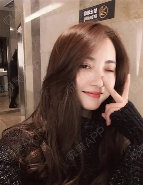 最近姐妹们的问题比较多的是做完后会不会有什么不适应...填充塑形悦美整形