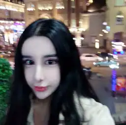 15岁清纯女孩整成蛇精脸自曝整容前后过程照