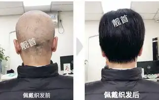 中年男士中老年假发套光头实拍案例