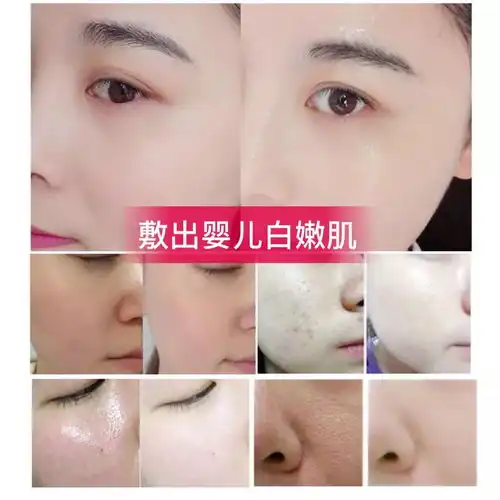 30片魔法世家竹炭美白补水面膜贴控油祛痘保湿祛斑男女去黑头膏
