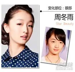 90后女星整容都整了哪,angelababy并非做的是整容鉴定