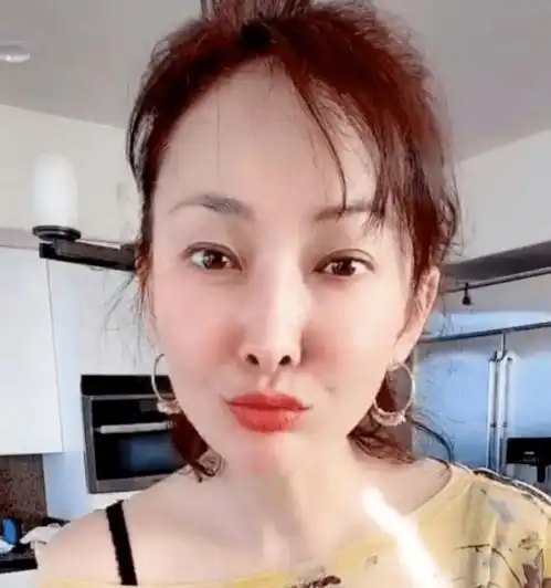 鼻长脸尖肿成发面团,中老年女星动脸简直是重灾区
