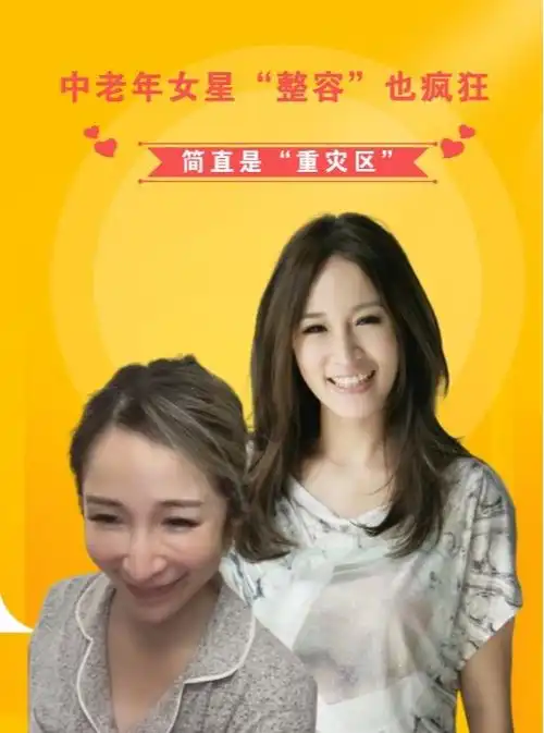 中老年女星整容也疯狂,刘晓庆蔡明自讨苦吃,最后一位变鞋拔脸张萌陈数牛莉