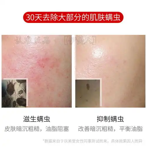 正品洗面奶除螨虫祛痘控油去黑头美白补水女男学生洁面乳深层清洁