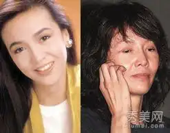 萧蔷黄奕萧亚轩因整容失败变成鬼脸的10大女星
