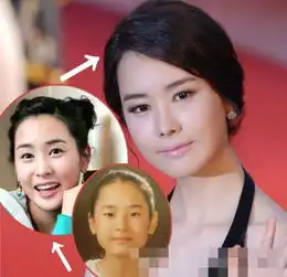 50岁尹贤淑整容变20岁曝二次整容变丑的韩国女星