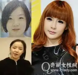 朴春承认整容失败整容前旧照被扒差别惊人