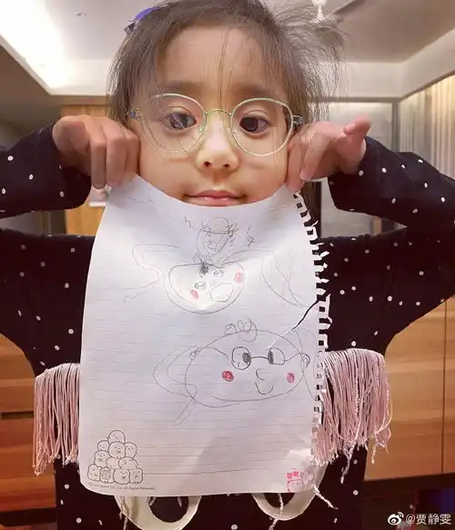贾静雯女儿被查出先天弱视已配眼镜治疗