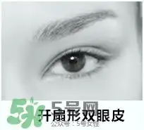 欧式双眼皮适合什么人欧式双眼皮前后对比