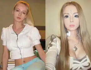 真人芭比娃娃瓦莱里娅露可安诺娃写真整容及生活照