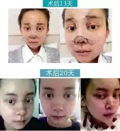 女子花百万整容成杨颖网友评论这钱没白花
