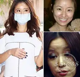 皮肤差长相老气9位女星未ps素颜吓死你